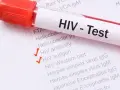 Probówka z krwią i formularz z zaznaczonymi testami na HIV.