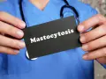 Lekarz w niebieskim kitlu trzyma kartę z napisem "Mastocytoza".