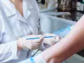 Lekarz w białym fartuchu i rękawiczkach trzyma szczoteczkę do cytologii płynnej nad szkiełkiem.