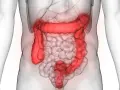 Anatomia jelita grubego podświetlona na czerwono na tle przezroczystego ciała ludzkiego.