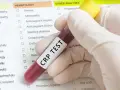 Ręka w rękawiczce trzyma probówkę z napisem "CRP TEST". Obok formularz z listą badań, m.in. hematologicznych.