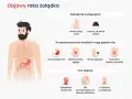 Ilustracja przedstawia objawy raka żołądka: utratę masy ciała, czarne stolce, uczucie pełności, niestrawność, zgagę, utratę apetytu, nudności, wymioty, osłabienie, ból pleców i trudności w połykaniu.