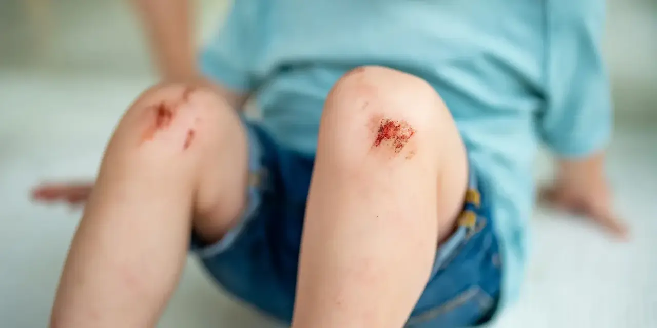 Dziecko z otartymi kolanami. Wczesne objawy tężca mogą być trudne do zauważenia, ale skaleczenia wymagają uwagi.