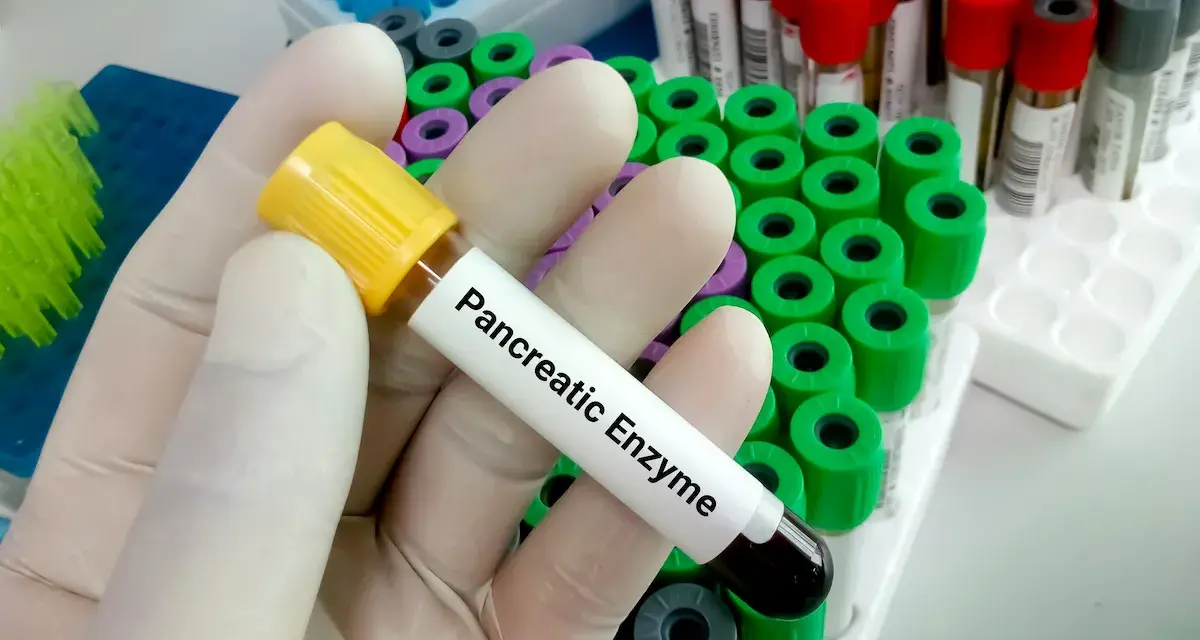 Ręka w rękawiczce trzyma probówkę z napisem "Pancreatic Enzyme", gotową do analizy. W tle widać wiele innych probówek.