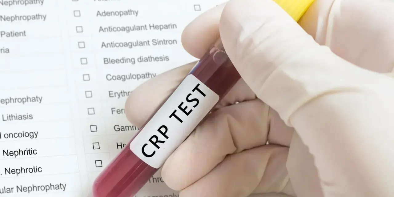 Ręka w rękawiczce trzyma probówkę z napisem "CRP TEST". Obok formularz z listą badań, m.in. hematologicznych.