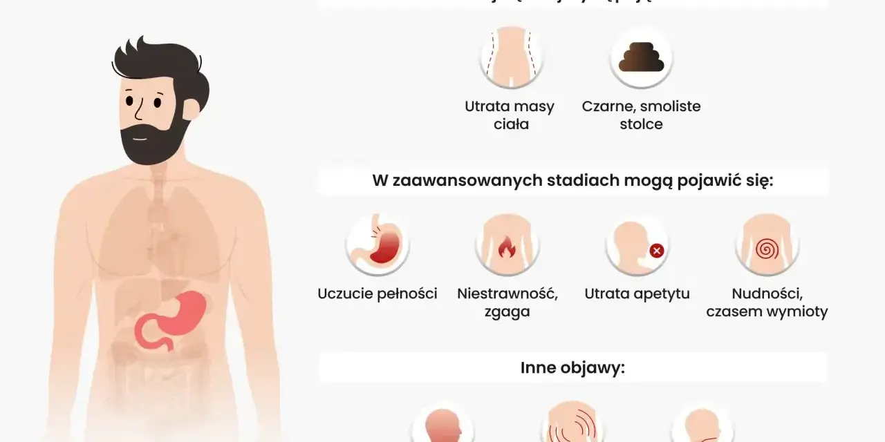 Ilustracja przedstawia objawy raka żołądka: utratę masy ciała, czarne stolce, uczucie pełności, niestrawność, zgagę, utratę apetytu, nudności, wymioty, osłabienie, ból pleców i trudności w połykaniu.