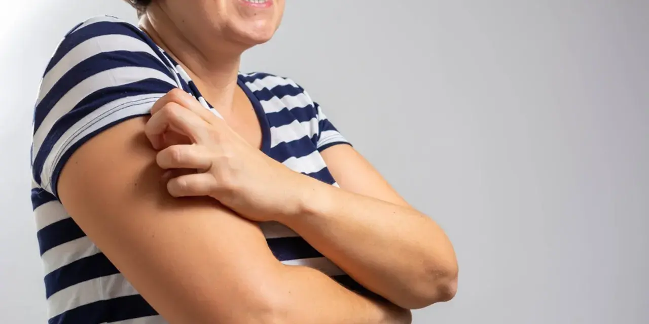 Kobieta w pasiastym T-shircie drapie się po ramieniu, doświadczając bardzo nietypowe objawy menopauzy, takie jak swędzenie skóry.