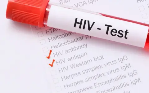 Probówka z krwią i formularz z zaznaczonymi testami na HIV.