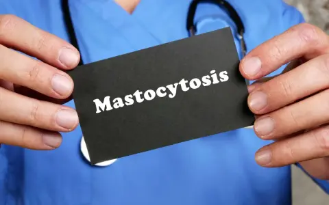Lekarz w niebieskim kitlu trzyma kartę z napisem "Mastocytoza".