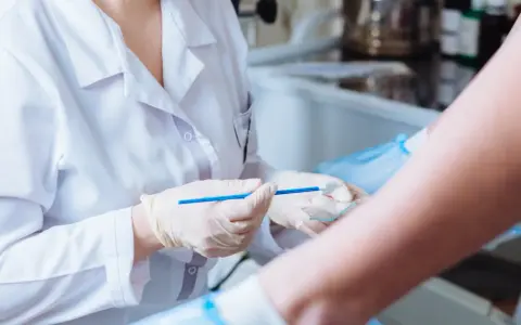 Lekarz w białym fartuchu i rękawiczkach trzyma szczoteczkę do cytologii płynnej nad szkiełkiem.
