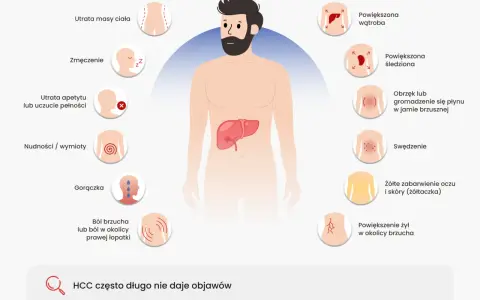 Ilustracja przedstawia objawy raka wątroby: utratę masy ciała, zmęczenie, powiększoną wątrobę, obrzęk brzucha, żółtaczkę.