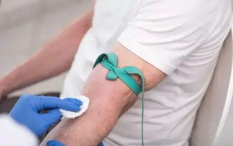 Ręka pacjenta z opaską uciskową i wacikiem, przygotowywana do pobrania krwi.