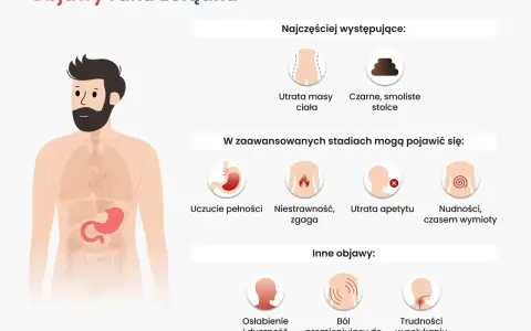 Ilustracja przedstawia objawy raka żołądka: utratę masy ciała, czarne stolce, uczucie pełności, niestrawność, zgagę, utratę apetytu, nudności, wymioty, osłabienie, ból pleców i trudności w połykaniu.