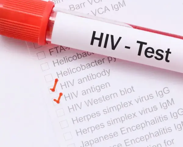 Probówka z krwią i formularz z zaznaczonymi testami na HIV.