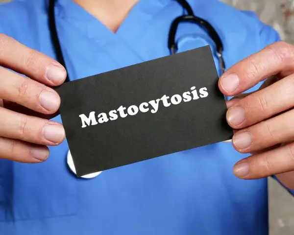 Lekarz w niebieskim kitlu trzyma kartę z napisem "Mastocytoza".