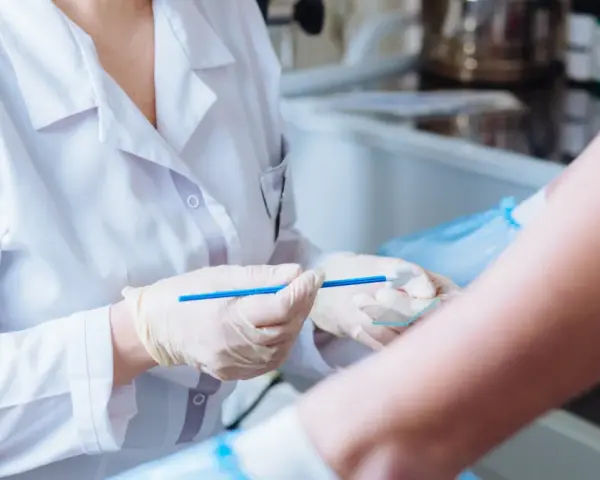 Lekarz w białym fartuchu i rękawiczkach trzyma szczoteczkę do cytologii płynnej nad szkiełkiem.