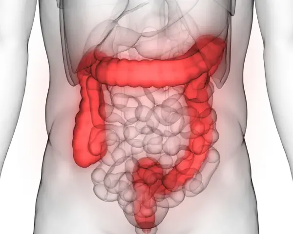 Anatomia jelita grubego podświetlona na czerwono na tle przezroczystego ciała ludzkiego.