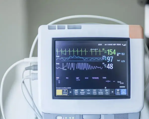 Monitor EKG pokazuje parametry życiowe: tętno 154, saturację 97, oddech 48. To jest co to ekg.