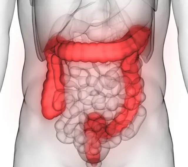 Anatomia jelita grubego podświetlona na czerwono na tle przezroczystego ciała ludzkiego.